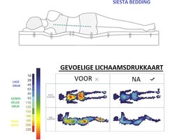 Siesta Bedding® – Lynn – Orthopedische Hybride Matras – Topcomfort – Afneembare en Wasbare Bamboe Hoes – 180x200 20cm – Slaapmagie - Matras